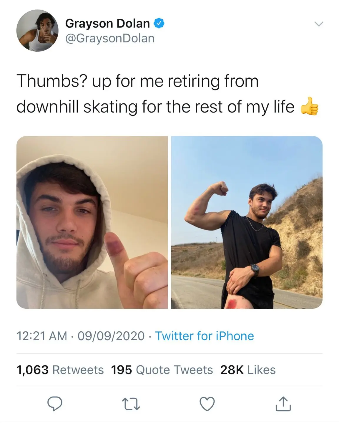 Grayson Dolan injures himself whilst downhill skating 3 Never going for downhill skating