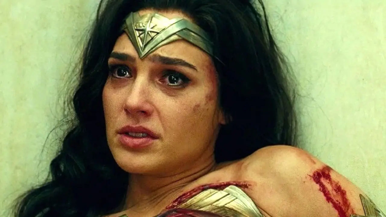Gal Gadot explains how she accidentally cut part of her finger off 1 Gal Gadot explains how she accidentally cut part of her finger off